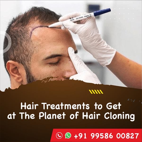 Hair Treatments to Get at The Planet of Hair Cloning